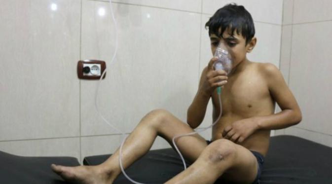Seorang anak menggunakan masker oksigen akibat kesulitan bernapas (AFP)