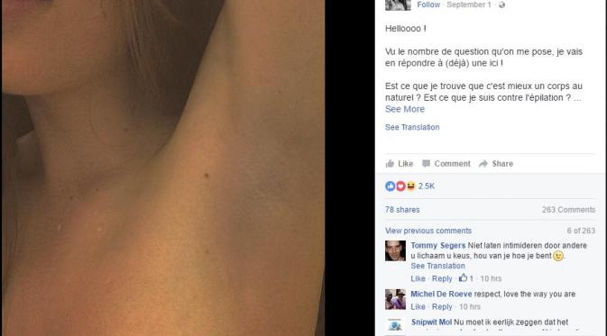 Gadis cantik yang di-bully karena mengunggah foto yang memperlihatkan bulu ketiak di Facebook kini telah mencukur bulu ketiaknya. (Sumber: Screenshoot Facebook Laura De)