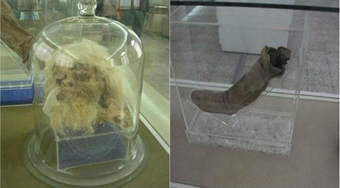 Biasanya mumi diawetkan dengan menggunakan ramuan tertentu atau terawetkan oleh es. Di Iran, mumi ini terawetkan oleh garam. (Sumber Nasser Sadeghi/Museum Bastaan)