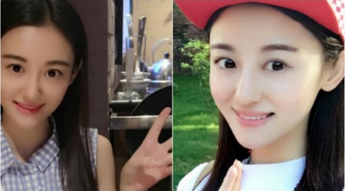 Xu Ting (26) meninggal dunia akibat kanker limfoma. Sejumlah pihak lain berpendapat bahwa Xu bisa saja melakukan dua jenis pengobatan untuk saling melengkapi. (Sumber Weibo via Daily Mail)
