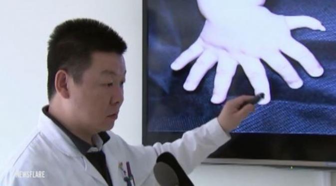 Xu Jihai, dokter yang menangani. (Via: mirror.co.uk)