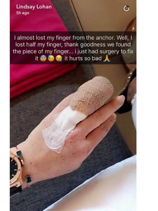 Lindsay Lohan memperlihatkan jari manisnya yang putus, dan baru saja disambung lewat sebuah operasi (Sumber: E! News)