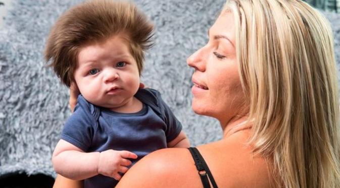 Junior Cox-Noon, bayi berusia 8 minggu yang punya 'rambut singa' bersama sang ibu, Chelsea. (Mirror)