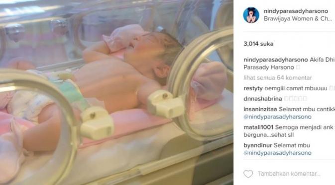 Nindy dikaruniai anak kedua (Instagram) 