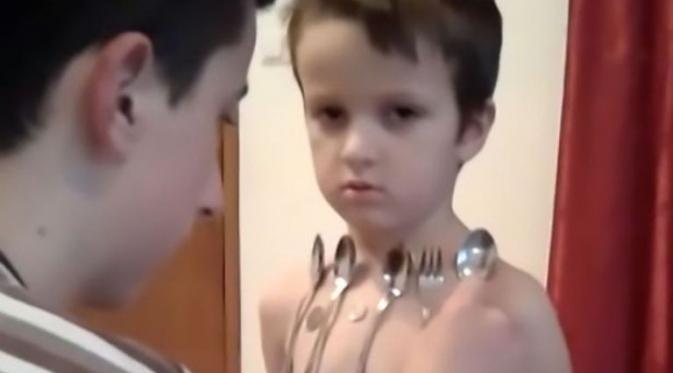 Erman Delic, bocah 5 tahun yang tubuhnya mampu menyerap benda-benda berbahan logam. (Via: mirror.co.uk)