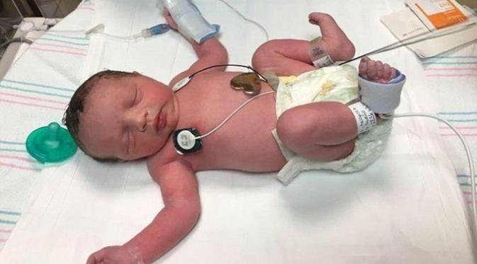 Bayi Lynlee Boemer yang lahir dua kali. (Foto: itv.com)