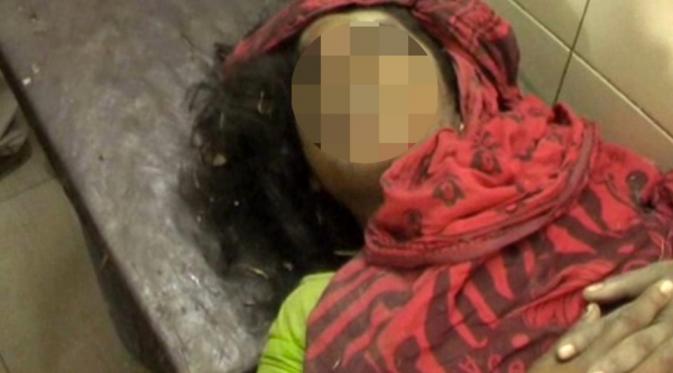 Ushar Devi tergeletak di Rumah Sakit usai babak belur dipukuli 25 warga | via: thesun.co.uk