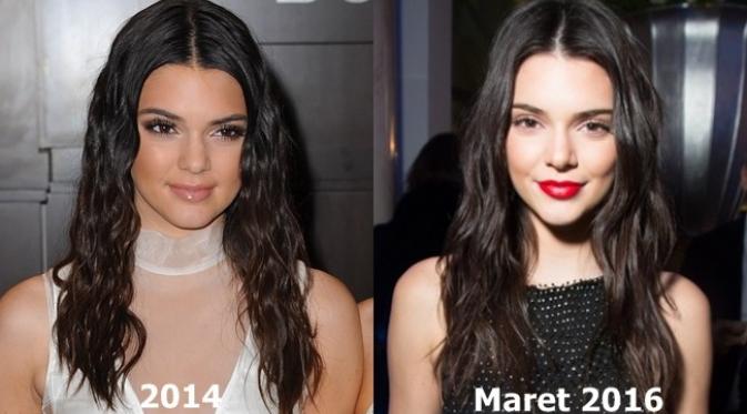 Kendall Jenner diduga melakukan filler bibir. (AFP/Bintang.com)