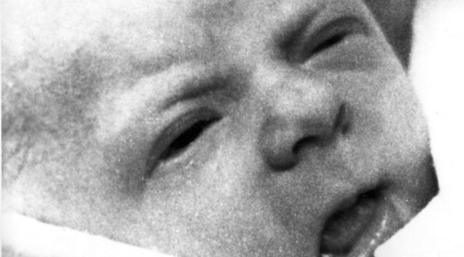 Louise Joy Brown, bayi tabung pertama di dunia. (AP)