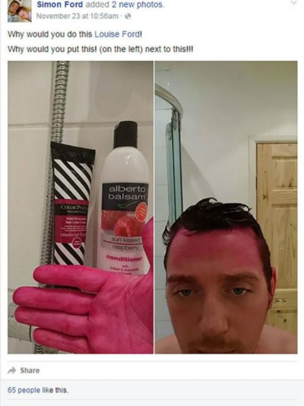 Setelah memakai sampo, rambut dan tangan pria ini menjadi pink 