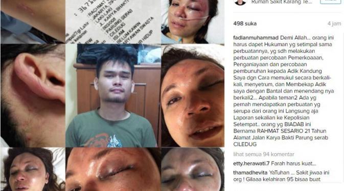 Adik Fadlan Muhammad dianiaya hingga diancam diperkosa (Instagram/@fadlanmuhammad)