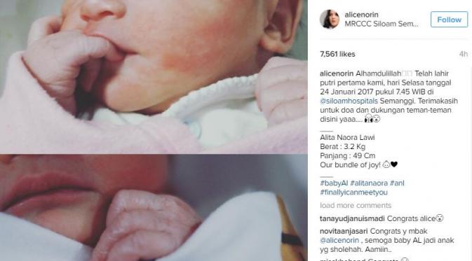 Alice Norin melahirkan bayi perempuan (Instagram/@alicenorin)