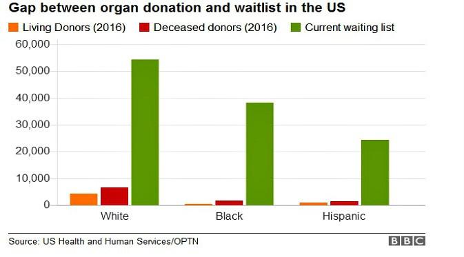 Grafik dari ras yang donor organ dan penerima organ dalam daftar tunggu. (Ilustrasi: BBC)