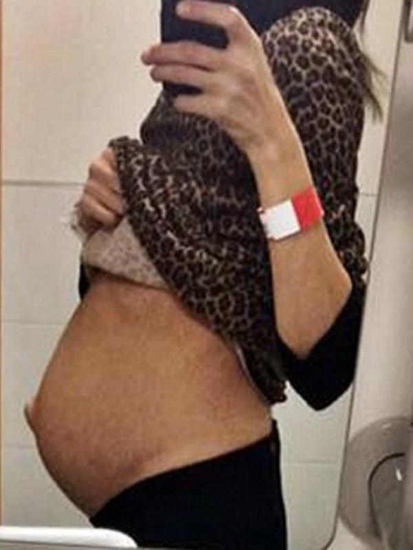 Maria pada saat masih memiliki tumor pada rahimnya. | via: dailymail.co.uk