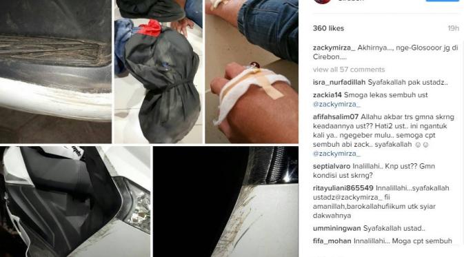 Ustaz Zacky Mirza alami kecelakaan (Instagram)