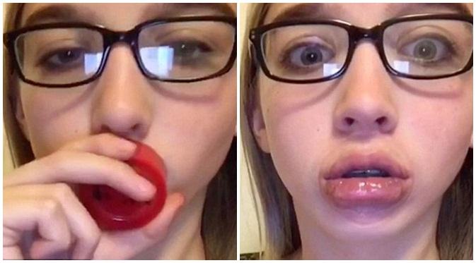 Begini cara remaja putri membuat bibir seseksi Kylie Jenner (dailymail.co.uk)