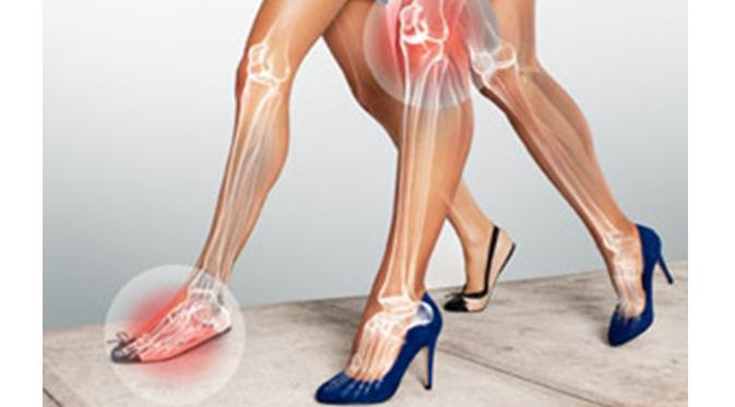 Kerusakan pada otot kaki dan telapak kaki (Via: linkedin.com)