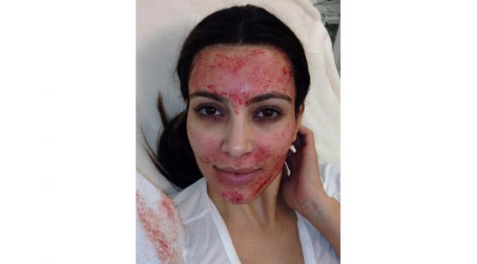 Apa sajakah ritual kecantikan aneh yang dilakukan oleh selebriti Hollywood?