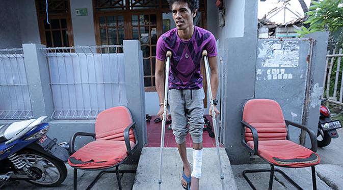 Alfi Tuasalamony rajin berlatih jalan untuk membantu proses penyembuhan cederanya. (Bola.com/Peksi Cahyo)