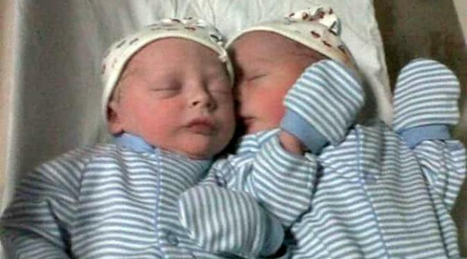 Bobby dan Riley saat baru lahir. Mereka masih terlihat mirip.