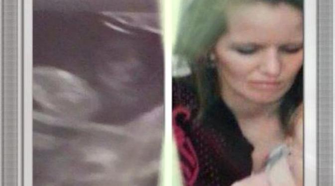 Wanita hamil melihat sosok penampakan wajah mendiang ibu di foto USG janin bayinya.