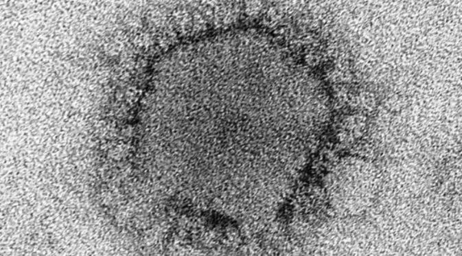 Virus MERS (MERS-CoV) (Credit: CDC/ Cynthia Goldsmith, Azaibi Tamin)