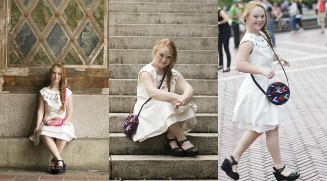 Kolaborasi antara industri fesyen dengan model down syndrome terbentuk dalam kampanye tas `The Madeline`.