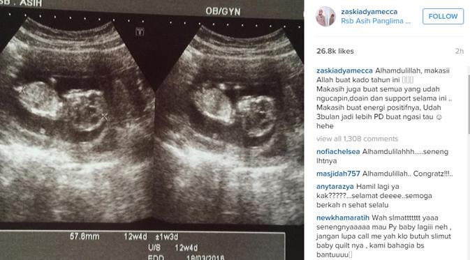 Zaskia Adya Mecca memperlihatkan hasil USG kehamilan anak ketiganya. (foto: instagram.com/zaskiadyamecca)