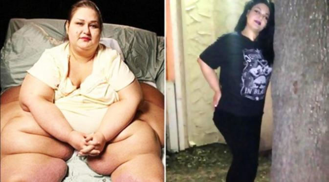 Sama seperti Farhat Abbas, Mayra Rosales juga mengalami kegemukan, berat badannya pernah mencapai 455 kg. Beruntungnya setelah menjalani operasi pengangkatan lemak kini berat badannya sudah ideal. | via: s1.dmcdn.net