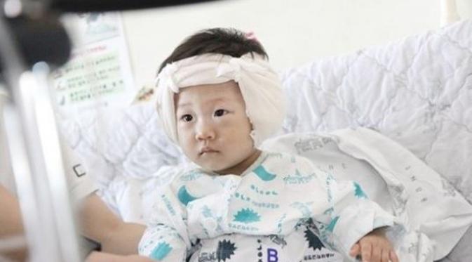 Anak kecil yang menerima donasi untuk implan Koklea dari CriJ, klub fans Jang Geun Suk