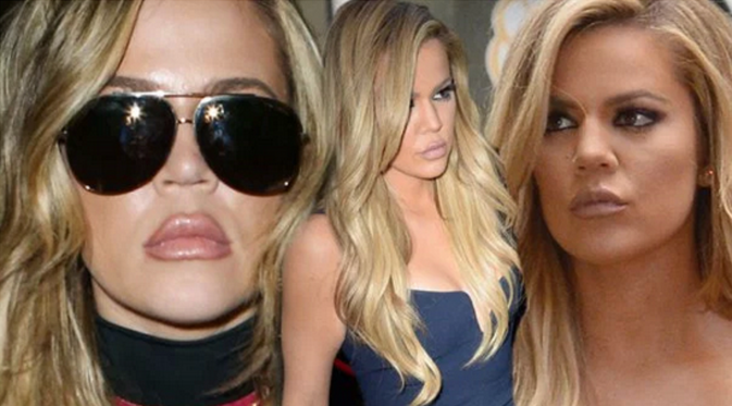 Perubahan pada bibir Khloe Kardashian dengan bibirnya yang kini terlihat lebih penuh [foto: RadarOnline]